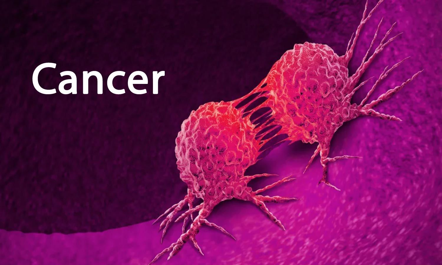 How To Prevent And Manage Cancers In The Human Body