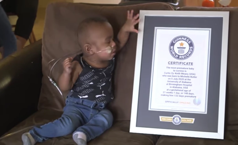 21 Weeks Infant Breaks Guinness World Record For Most Premature Baby To Survive